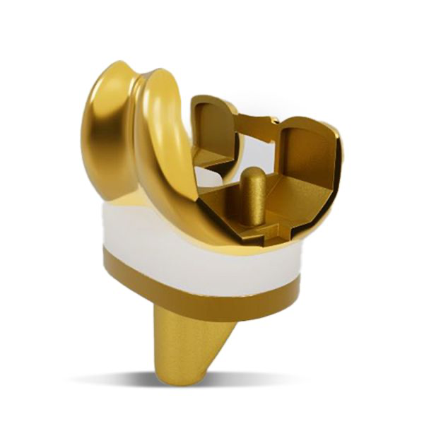 Opulent knee implant