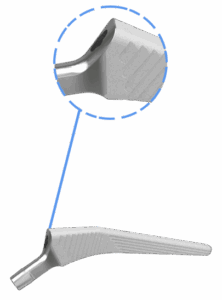 Low-profile shoulder