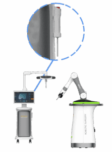 Femoral and tibial cutting guide Robotic femoral and tibial cutting guide